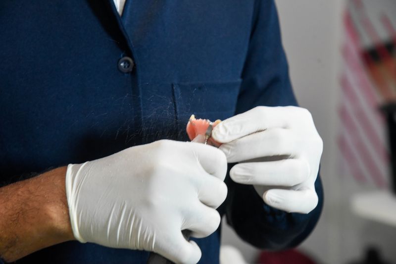 Serviços e entrega de Prótese no CEO